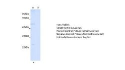SLC25A26 Rabbit anti-Human, Polyclonal, Novus Biologicals 0.1 mL | Buy Online | Novus Biologicals | Fisher Scientific